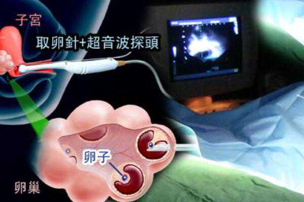 优质代生服务,天津试管助孕生子助孕机构多少钱-试管生殖助孕机构