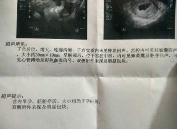 泰国借卵子生男孩,我为什么去泰国做试管婴儿？分享我的泰国试管婴儿的心酸