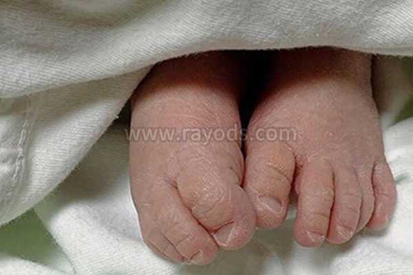 泰国医院能借卵吗,泰国试管双胎男宝经历，附泰国试管婴儿医院试管感受