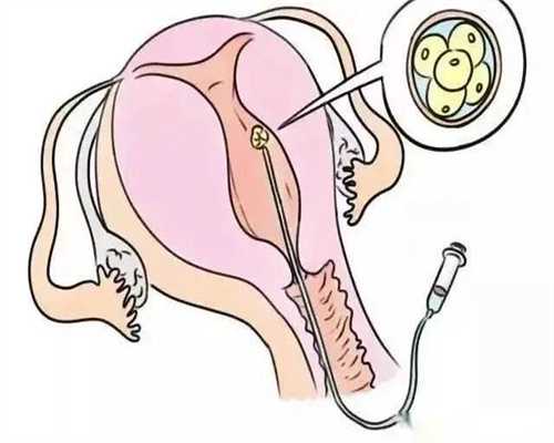 泰国失独代孕,[酒泉试管婴儿]去泰国做试管婴儿有什么安全保障吗